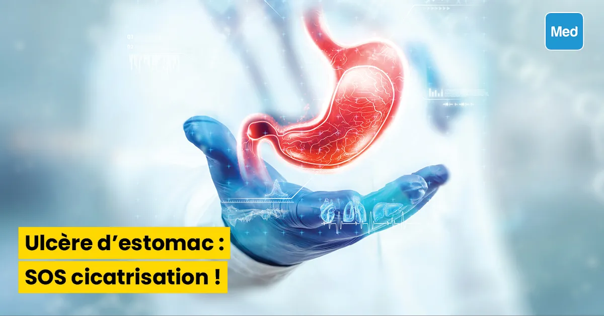 Ulcère d'estomac : SOS cicatrisation !
